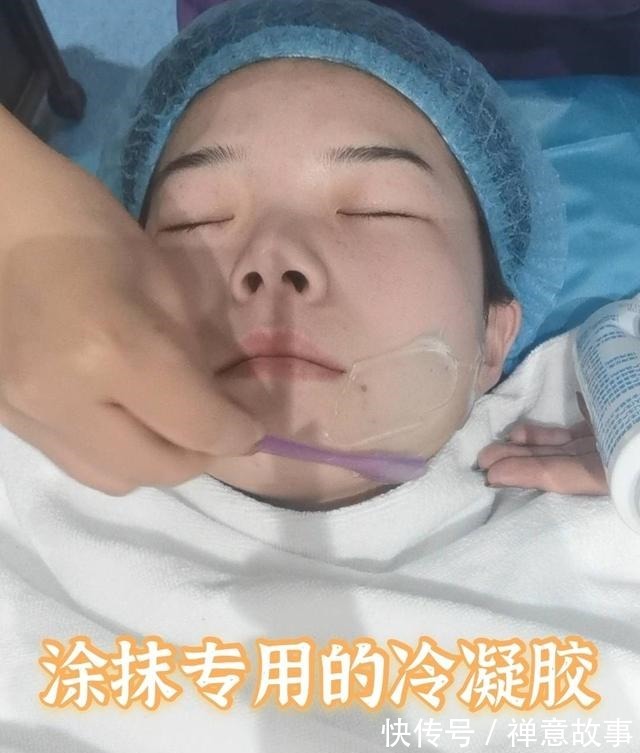 仪器 医美界的万金油,光子嫩肤探店!