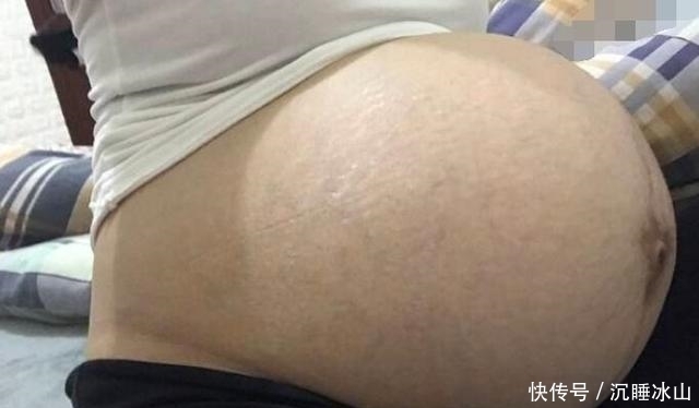 食补|孕期常常腿抽筋？提醒孕妈该补钙了！营养师：首先食补且牢记3点