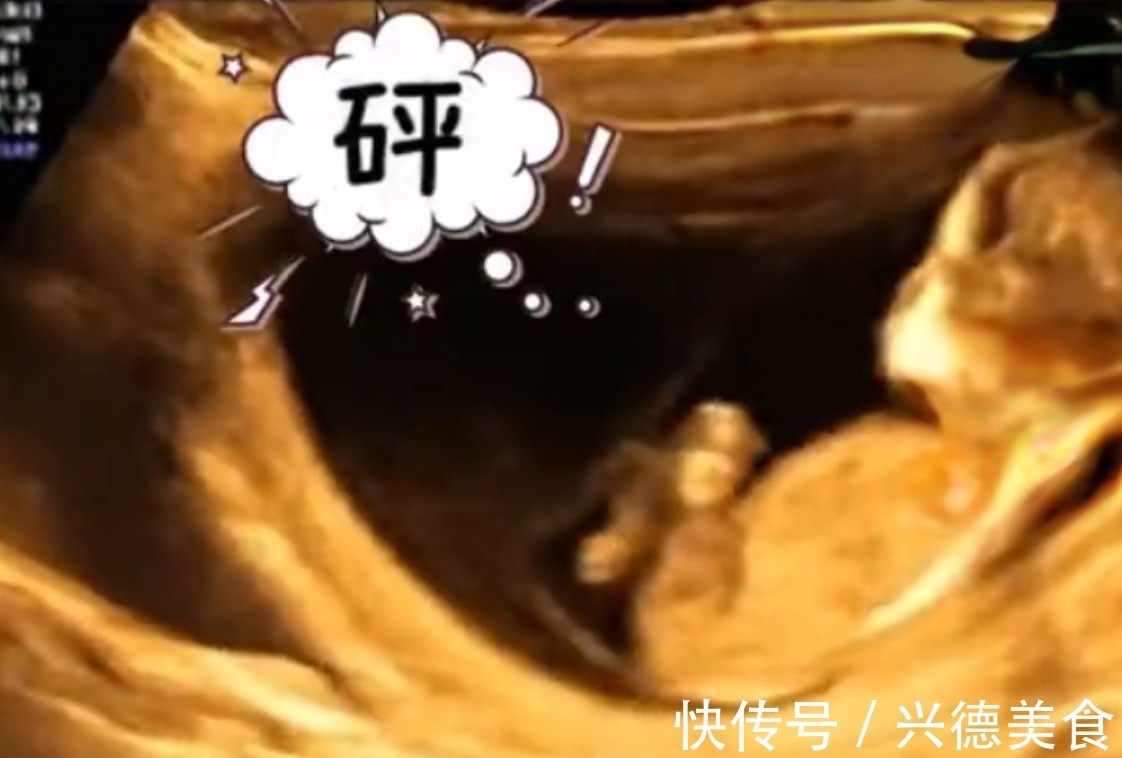 外面的世界|孕妈做四维彩超时突然腹痛,B超显示让人忍俊不禁,网友:挺无辜