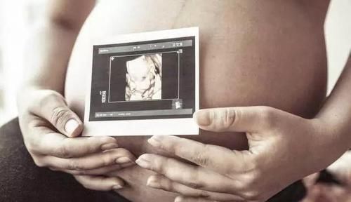 怀孕后,为啥有人孕吐不断,有人却没反应,医生与2个因素有关