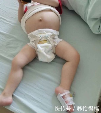 饮食习惯|连石头都能“消化”的鸡内金,能健脾化痰,但是很多人都不会用