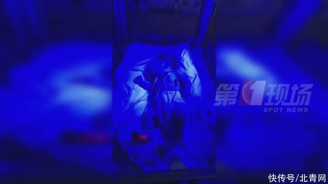 肺动脉|暖！“熊猫血”妈妈生下心脏病宝宝，一场救治接力就此上演…