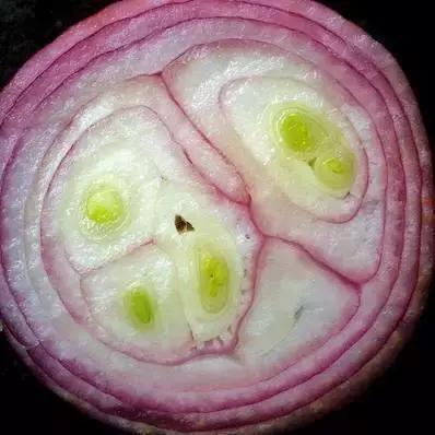 有没有|这条糖尿病线,你手上有没有如果看到它,请注意了