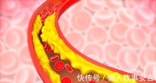 平稳|这3种食物会导致血脂升高,为保血脂平稳,奉劝你别再往嘴里送