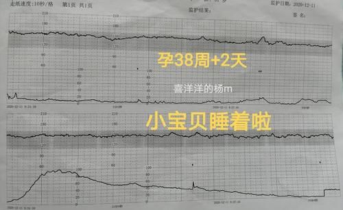 检查|孕38周+2天，做常规产检，胎心监测，羊水量检测，全过关