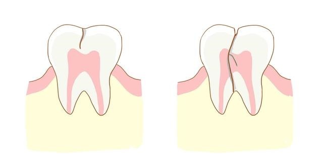 ct|肝部癌症,牙齿先知若牙齿有这3异常,建议去做CT