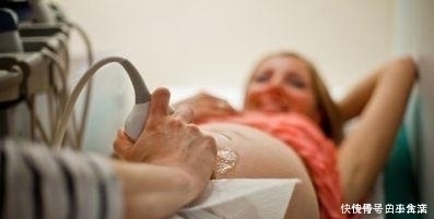 妈妈们|B超单上若有这五个字,孕妈就乐吧,可能是“小淘气”来敲门了