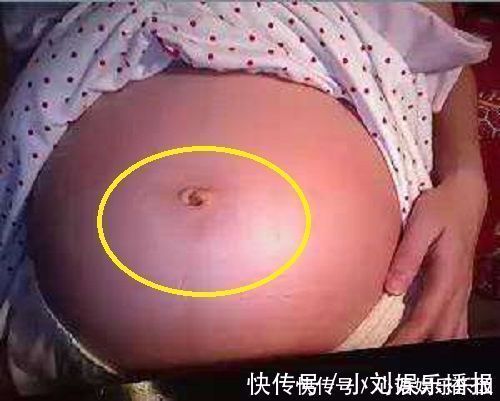 怀孕期间|女性怀孕后,肚脐眼是凸起是凹进,受3个因素影响,别轻易忽视