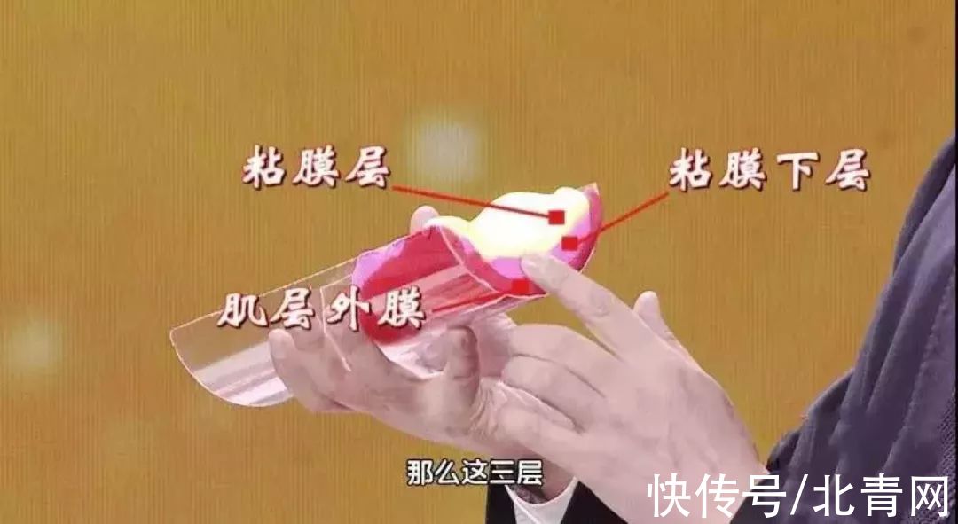 晚期|这种偏爱中国人的癌症，往往一发现就是晚期，这4个症状千万别大意