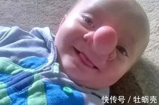 丈夫|一女子生出奇怪宝宝,丈夫吓到要离婚,两年后丈夫后悔了!