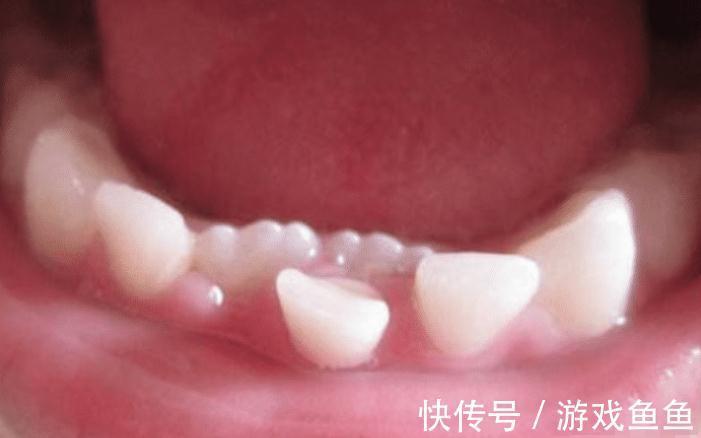 孩子|孩子这颗牙有大“作用”,父母别再乱丢了,关键时刻能救娃一命