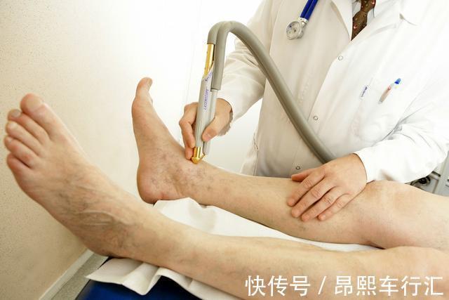 糖尿病|糖尿病下肢消瘦如何改善？除了控制好血糖，这两点值得重点关注