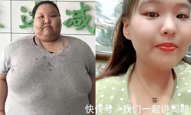 减肥|400斤女孩把床压塌只敢睡地上,今减掉230斤美的连亲妈都认不出