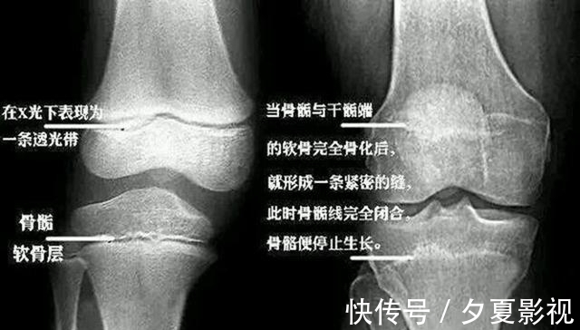 发育|53万儿童“性早熟”,这些食物正“催熟”我们的孩子,很多家长还成箱买