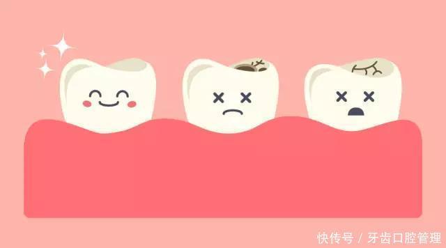宝妈|宝宝蛀牙千千万,及早发现才是真理