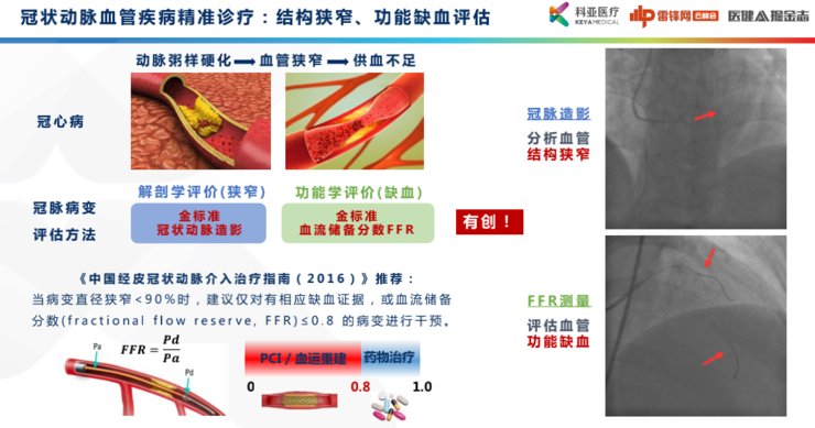 功能学|科亚医疗曹坤琳：合规认证、数据集建设，医疗AI首证背后的经验全盘点