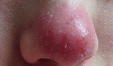 肝脏|身上出现这6个信号,尽快去医院检查一次肝功能,晚了就后悔吧