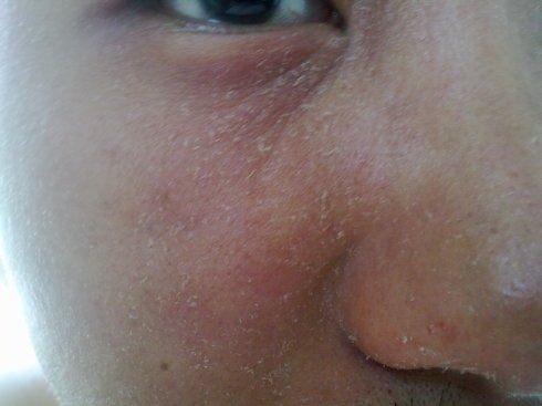 春夏季常见的护肤行为