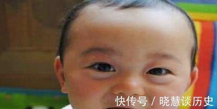 食物|孩子积食难消化,脸上或有3种变化,不忌口4种食物,娃身高难长