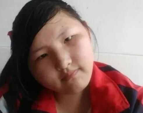 精致|女生最“不能胖”的几个部位,五官再精致都白搭,全占你就毁了