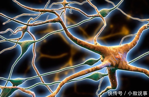 萃枫苷|我国为何成为老年痴呆高发国？3类食物是罪魁祸首，你必须得知道