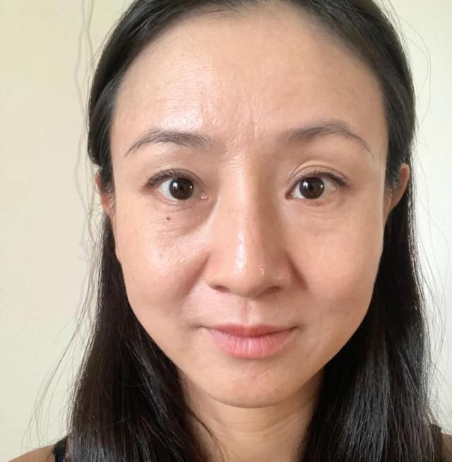 你是“真性皱纹”or“假性皱纹”?从这3点就知道,后者还能拯救