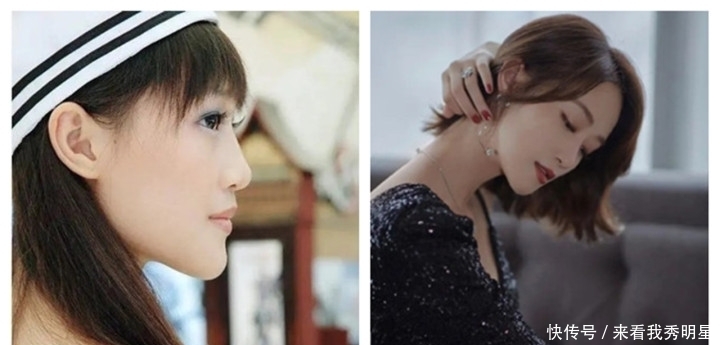 眼是美之窗，鼻是颜之魂；范芳医生谈国人常见鼻型及美学特点一