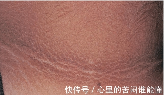 发黑|9岁小女孩脖颈发黑洗不掉,经医院检查后,医生的话却让家长笑了