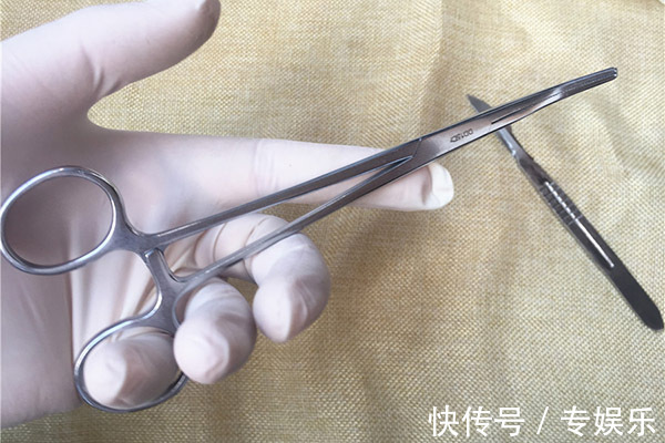 诱因|担心结节迟早要癌变,为什么不尽早切提醒患者,过度医疗不可取