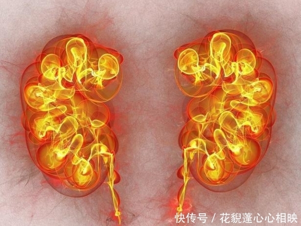 肾移植后还能活多久?你符合肾移植条件吗?