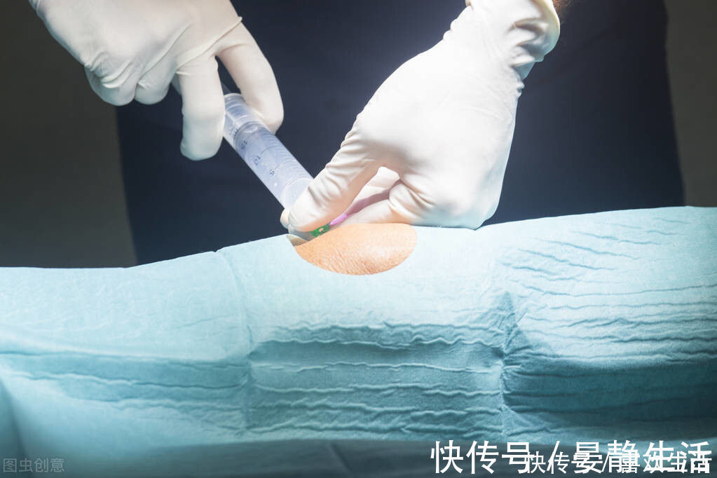 肿痛|骨科医生：一块生姜，不到半月，膝盖肿痛消失了，滑膜炎也好了