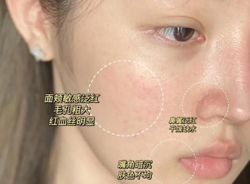 想让皮肤底子变好，建议做好3个护肤方法，很基础但容易被忽略