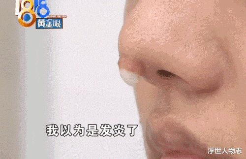 張檬|又是饅頭臉!婁藝瀟張檬孫菲菲,被玻尿酸害了的,還不止這些