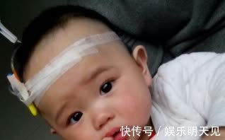 积食|6岁女童感冒半个月,原来是积食造成的,医生:这些食物千万别喂