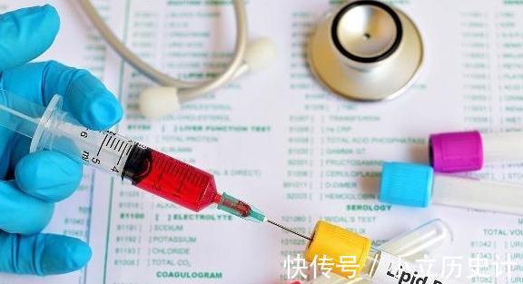 点心眼|留点心眼：身体有这5个不适，多是表示血脂在飙升