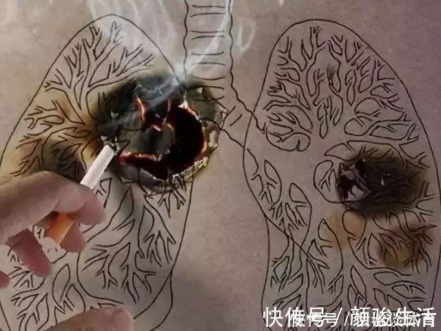 肺癌|大病来临前，身体各个方面发出的求救信号，你真的清楚吗？
