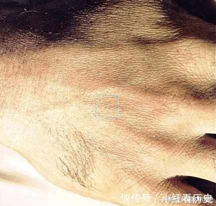 把我们的皮肤放大一亿倍,最后“超乎想象”