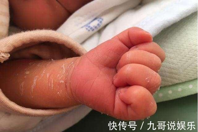 斗鸡眼|新生儿这些特殊生理现象,儿科医生孩子不是生病,不要乱花钱