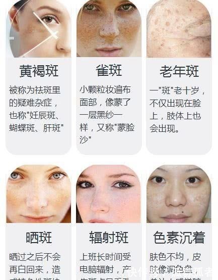 去斑 美白淡斑护肤品哪款好去斑快效果最好的品牌是哪个!
