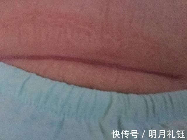 二胎政策|第一次剖腹和第二次有什么不同医生说出实话,孕妈要心里有数