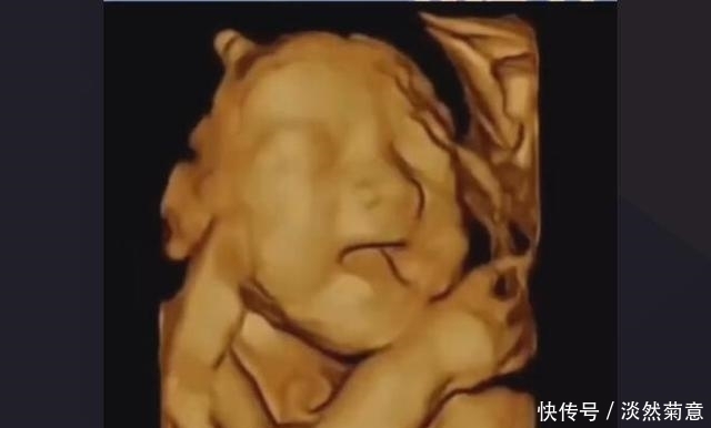 怀孕12周|孕期280天产检要点:时间、项目、注意事项,收藏这篇就够用了