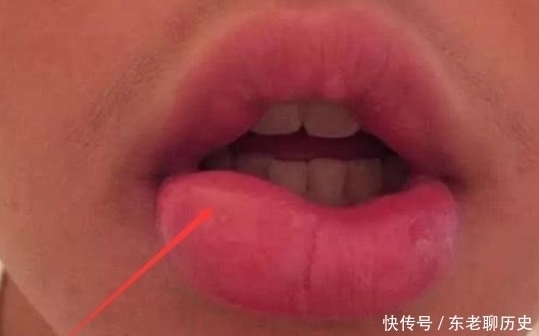 唇妆|学生党“贼伤嘴巴”的3动作,多数00后已中招,变“火锅嘴”可别哭