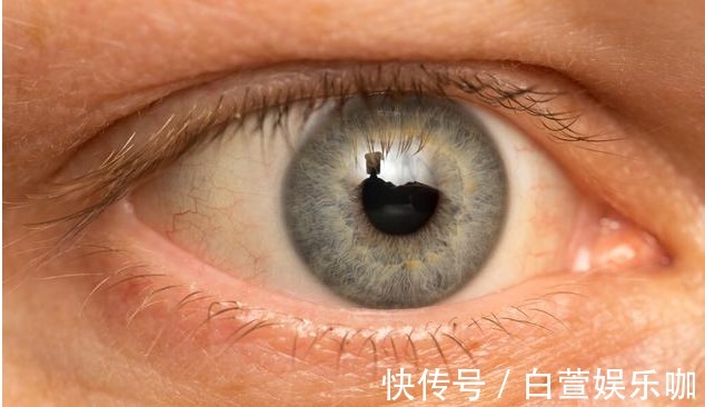 高血脂|血脂高不高，看头就知道，若没有4种症状，恭喜，血管还算通畅