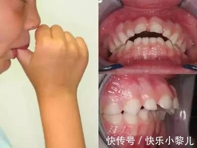 宝宝|有种“失误”叫做:冲着大宝的颜值生二宝,宝妈自嘲:翻车了