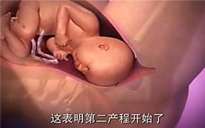 胎头那么大，到底是怎样从那么小的口出来顺产分娩全过程-附图