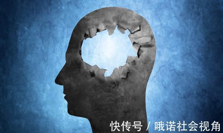 脑梗|脑梗多半是吃出来的！医生告诫：4类食物还不忌口，还会一堵再堵