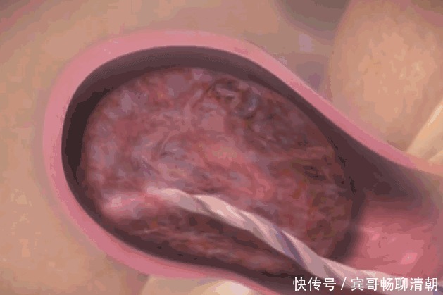 顺产到底有多疼3张图让你一目了然,妈妈太不容易,请善待她们