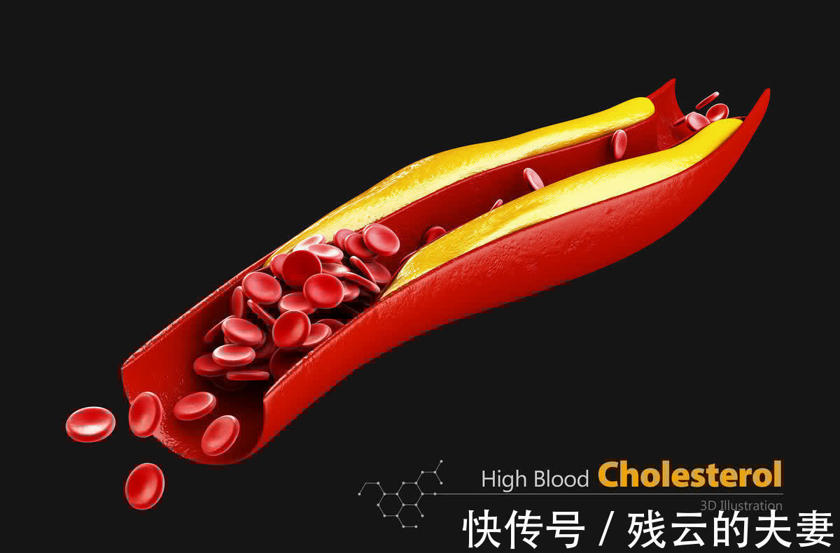 腰围|远离高血压、高血糖、高血脂“三高”的15句话，再忙也要看一看