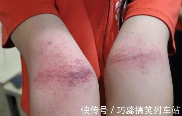 左手臂|人体自带4个长寿窝,每天只要5分钟,拍一拍,心肝脾肺肾都好了!