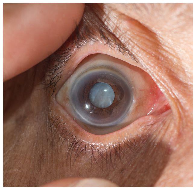 胰岛素|糖尿病找上你不用怕,做好这六件事,让你带“糖”健康